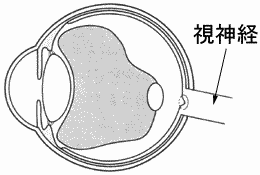 �ڂ̕a�C�^���ǁi�ЂԂ񂵂傤�j�㕔�Ɏq�̔����ƃ��e�C��