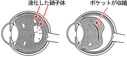 ���ǂ̌����ƃ��e�C��